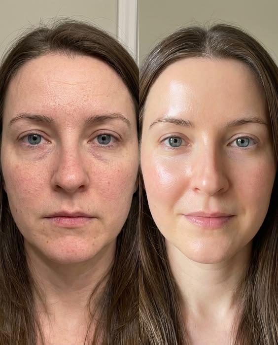 Before and After