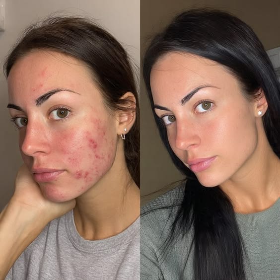 Before and After