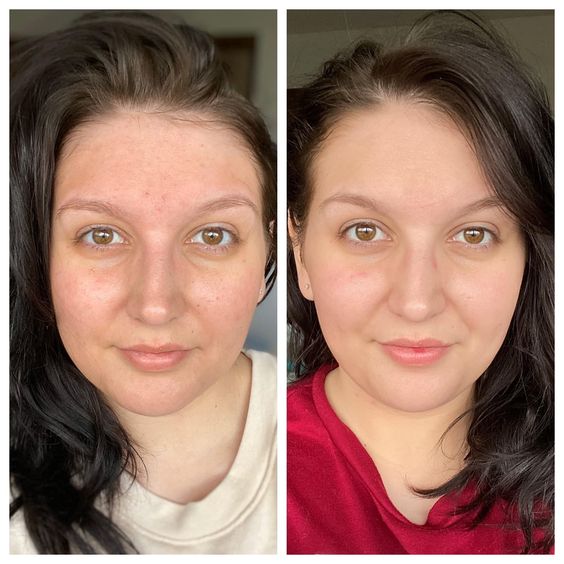 Before and After