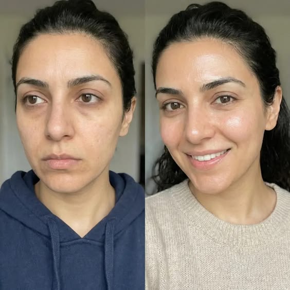 Before and After